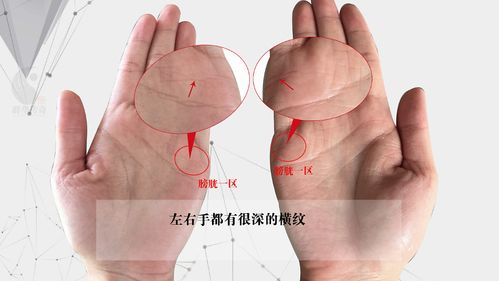 3分钟 教你学会看肾的手纹与反映出来的疾病 掌纹分析顾客(1)__凤凰网